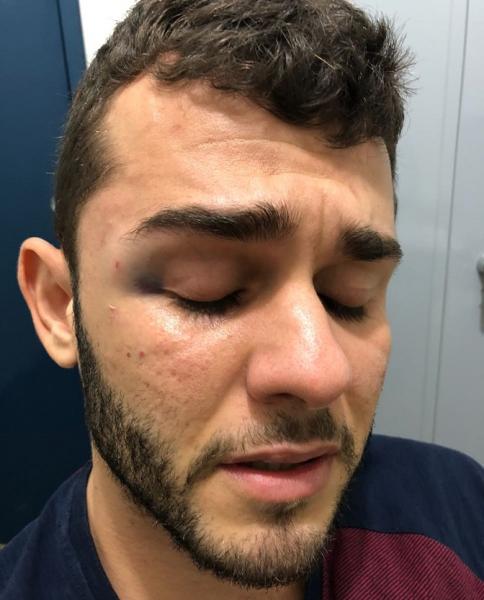 LIVRAMENTO: ADVOGADO É AGREDIDO POR POLICIAL MILITAR NA SEDE DA 46ª CIPM