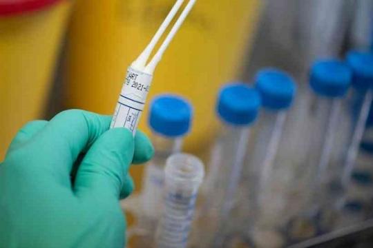Veja 10 verdades e 10 mentiras sobre a epidemia do novo coronavírus