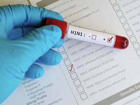 Novo boletim da Sesab aponta 13 mortes e 61 casos de H1N1 na BA