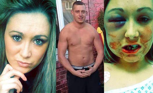 Garota fica com rosto deformado após recusar sexo e apanhar do ex-namorado