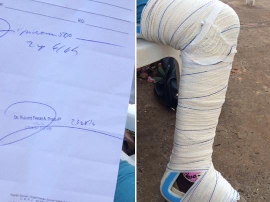 Idosa se machuca e tem perna enfaixada por cima da calça e do tênis