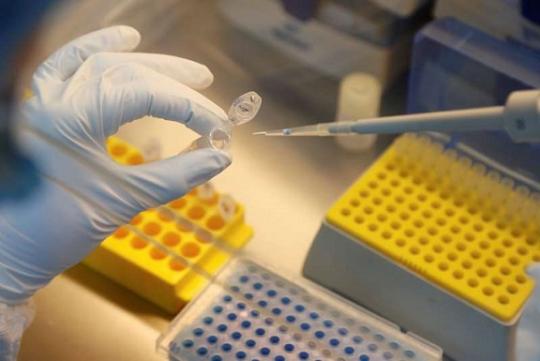 Rússia produzirá vacina experimental contra Covid-19 em massa neste ano, diz fundo de saúde